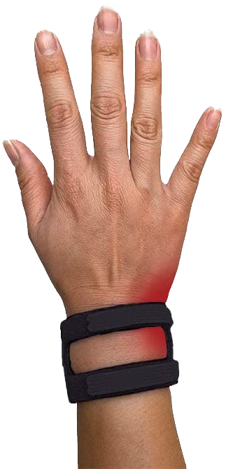 Image of ulnar wrist brace
